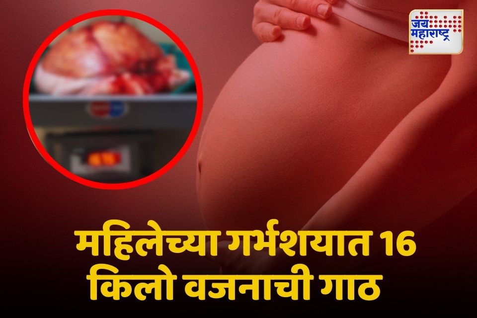 akola तब्बल 2 तास शस्त्रक्रिया करून डॉक्टरांनी दिले महिलेला जीवनदान 
