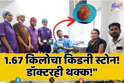 गोंदियात दुर्मिळ शस्त्रक्रिया, महिलेच्या पोटातून काढला 1.67 किलोचा किडनी स्टोन